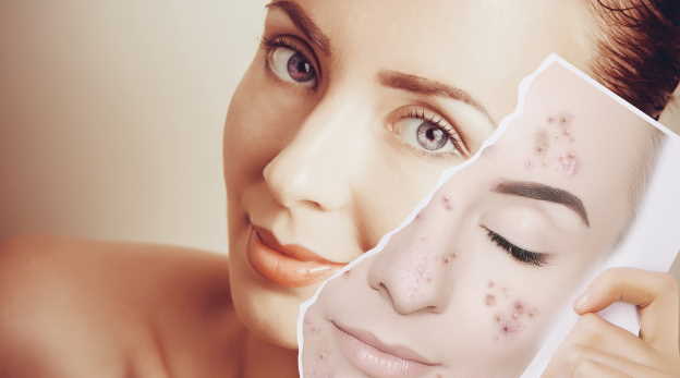 cover scars